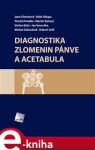 Diagnostika zlomenin pánve a acetabula - Martin Ryšavý, Jana Chmelová, Valér Džupa, Tomáš Pavelka e-kniha