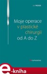 Moje operace v plastické chirurgii od A do Z - Jan Měšťák e-kniha