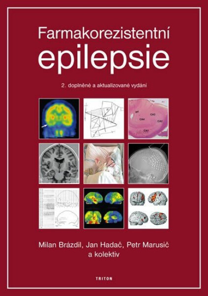 Farmakorezistentni epilepsie - 2. vydání - kolektiv autorů