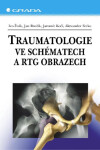 Traumatologie ve schématech a RTG obrazech - Ivo Žvák, Ferko Alexander, Jan Brožík, Jaromír Kočí