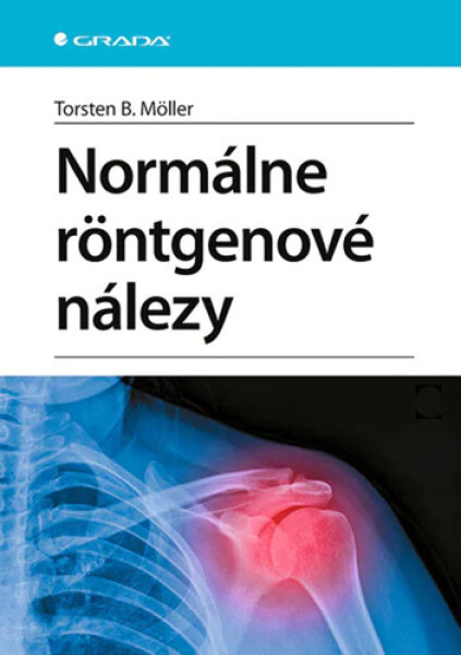 Normálne röntgenové nálezy