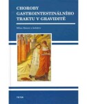 Choroby gastrointestinálního traktu v graviditě - Milan Kment