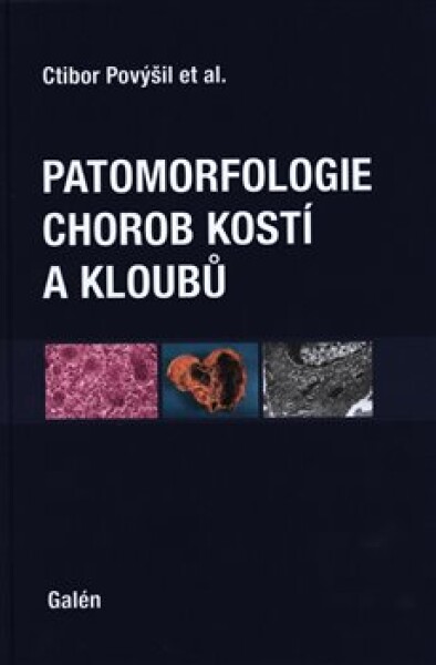 Patomorfologie chorob kostí kloubů