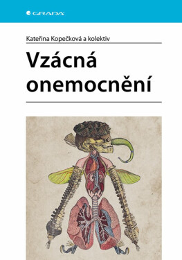 Vzácná onemocnění - Kateřina Kopečková