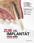 Zub vs. implantát - Bertani Pio, Generali Paolo, Gorni Fabio, Testori Tiziano