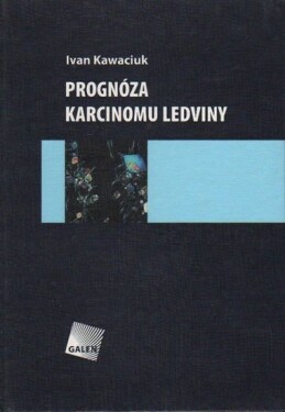 Prognóza karcinomu ledviny - Ivan Kawaciuk