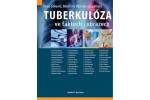 Tuberkulóza ve faktech obrazech Martina Vašáková,