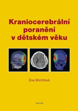Kraniocerebrální poranění v dětském věku - Eva Brichtová