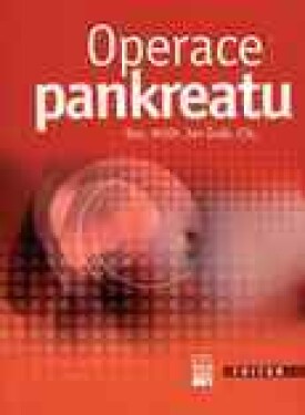 Operace pankreatu - Jan Šváb - e-kniha