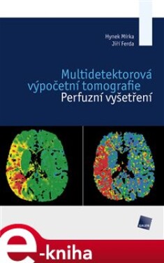 Multidetektorová výpočetní tomografie - Hynek Mírka, Jiří Ferda (e-kniha)