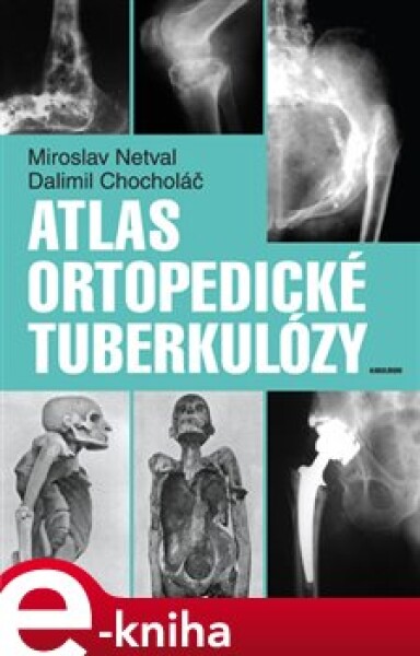 Atlas ortopedické tuberkulózy Dalimil Chocholáč,