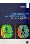 Multidetektorová výpočetní tomografie - Hynek Mírka, Jiří Ferda (e-kniha)