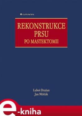 Rekonstrukce prsu po mastektomii - Luboš Dražan, Jan Měšťák e-kniha