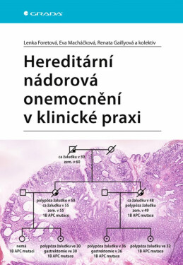 Hereditární nádorová onemocnění v klinické praxi - Lenka Foretová, Eva Macháčková, Renata Gaillová