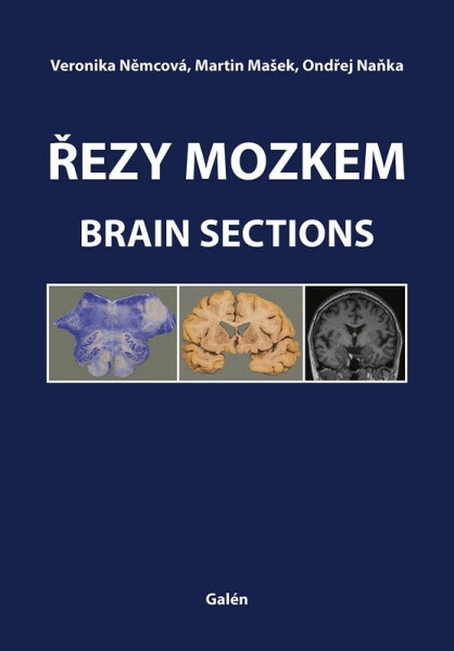 Řezy mozkem / Brain Sections - Ondřej Naňka