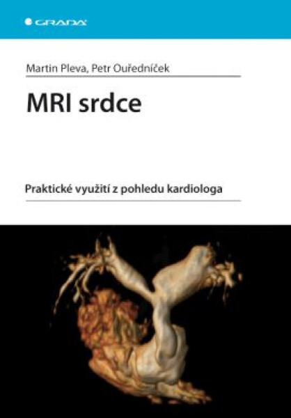 MRI srdce - Pleva Martin, Petr Ouředníček