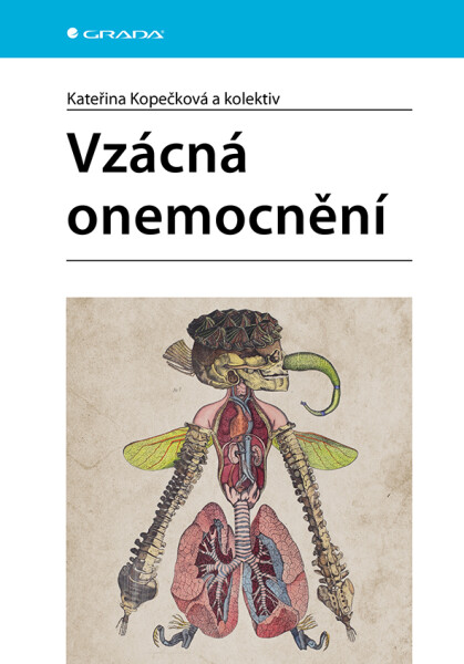 Vzácná onemocnění - Kateřina Kopečková