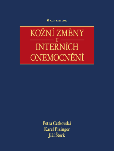 Kožní změny u interních onemocnění - Petra Cetkovská, Karel Pizinger, Jiří Štork - e-kniha