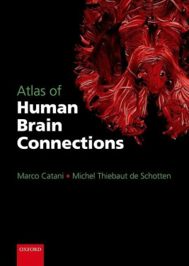 Atlas of Human Brain Connections DOPRODEJ