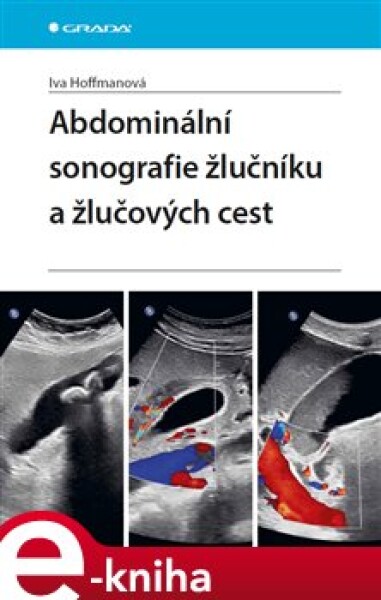 Abdominální sonografie žlučníku žlučových cest Iva Hoffmanová