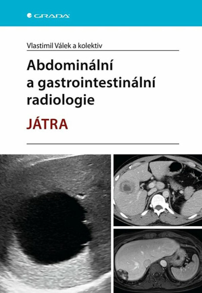 Abdominální a gastrointestinální radiologie - Vlastimil Válek, kolektiv autorů