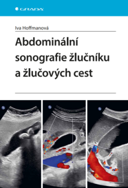 Abdominální sonografie žlučníku a žlučových cest - Iva Hoffmanová - e-kniha