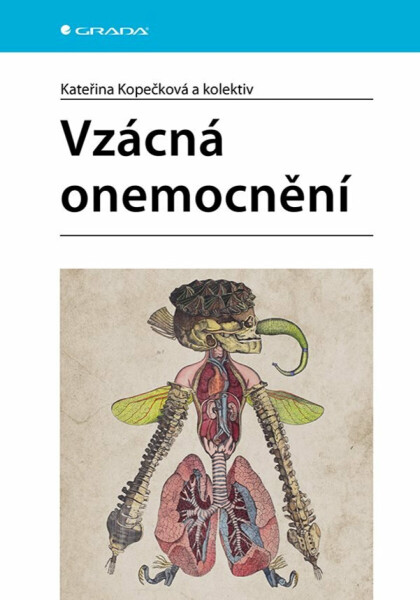 Vzácná onemocnění - Kateřina Kopečková