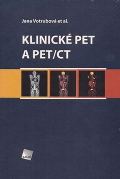 Klinické PET a PET/CT - Jana Votrubová