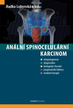 Anální spinocelulární karcinom