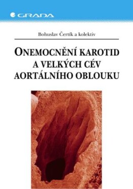 Onemocnění karotid a velkých cév aortálního oblouku - Bohuslav Čertík - e-kniha