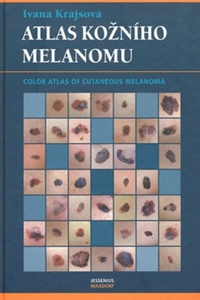 Atlas kožního melanomu