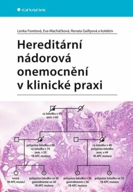 Hereditární nádorová onemocnění v klinické praxi - Lenka Foretová, Eva Macháčková, Renata Gaillová - e-kniha