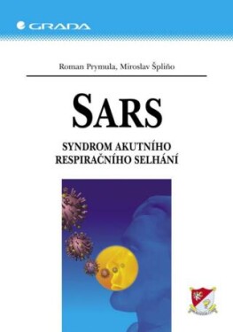 SARS - Roman Prymula, Miroslav Špliňo - e-kniha