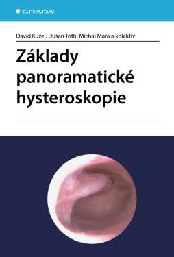 Základy panoramatické hysteroskopie - David Kužel, Tóth Dušan, Michal Mára