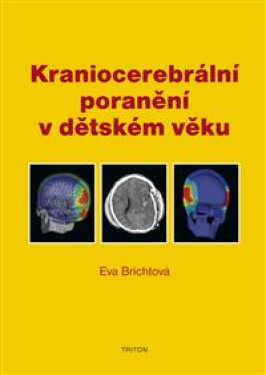 Kraniocerebrální poranění v dětském věku - Eva Brichtová