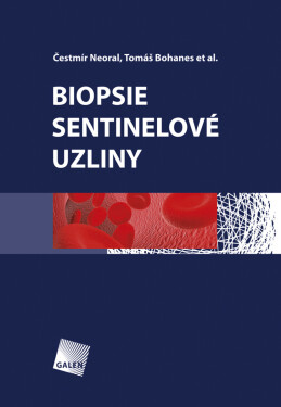 Biopsie sentinelové uzliny - Čestmír Neoral, Tomáš Bohanes