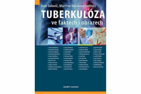 Tuberkulóza ve faktech i obrazech (poškozená) - Martina Vašáková, kolektiv autorů, Solovič Ivan