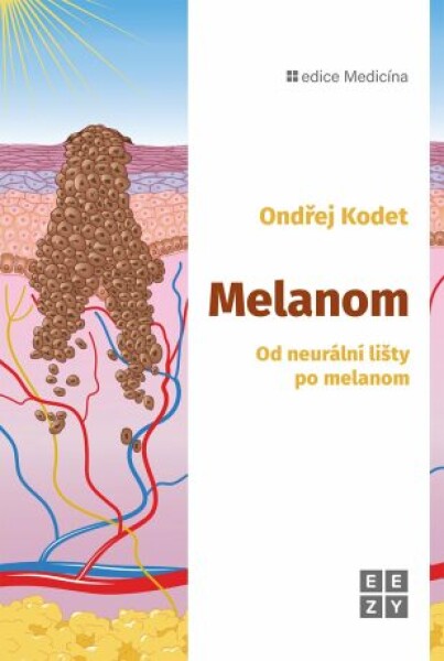 Melanom Ondřej Kodet
