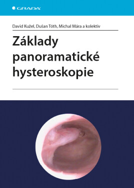 Základy panoramatické hysteroskopie Kužel David