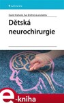 Dětská neurochirurgie