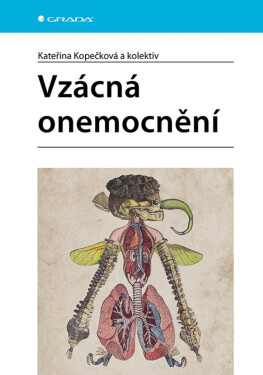 Vzácná onemocnění - Kateřina Kopečková