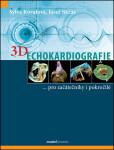 3D Echokardiografie