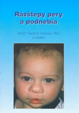 Rázštepy pery podnebia