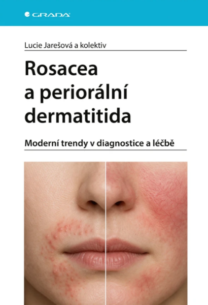 Rosacea a periorální dermatitida - kolektiv autorů, Lucie Jarešová