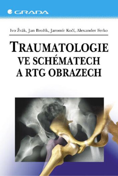 Traumatologie ve schématech a RTG obrazech - Ivo Žvák, Ferko Alexander, Jan Brožík, Jaromír Kočí