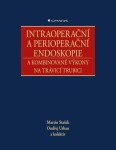 Intraoperační a perioperační endoskopie a kombinované výkony na trávicí trubici - kolektiv autorů, Ondřej Urban, Stašek Martin - e-kniha