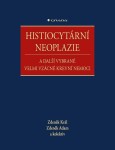 Histiocytární neoplazie další vybrané vzácné krevní nemoci