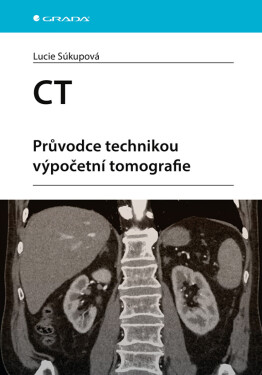 CT - Průvodce technikou výpočetní tomografie - Lucie Súkupová
