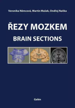Řezy mozkem / Brain Sections - Ondřej Naňka, Martin Mašek, Veronika Němcová