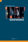 Keratokonus